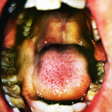 Hana Vu: Public Storage (Clear & White Marbled Vinyl) (Vinyl LP)