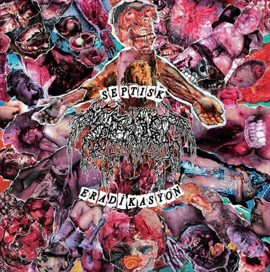 Septage: Septisk Eradikasyon (7-Inch Single)