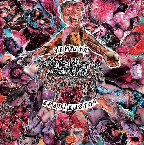 Septage: Septisk Eradikasyon (7-Inch Single)